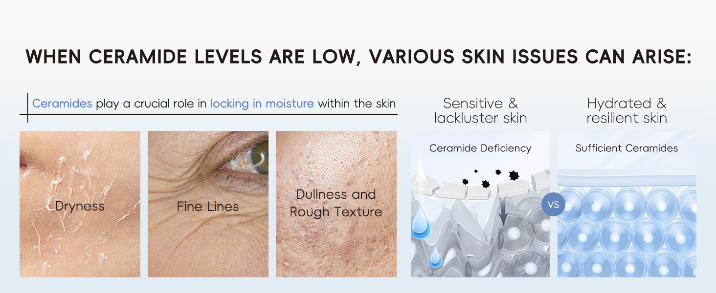 ceramide skincare set