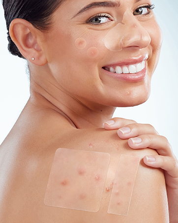 large pimple patches