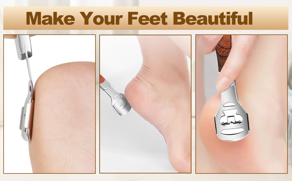 Foot File Callus Remover