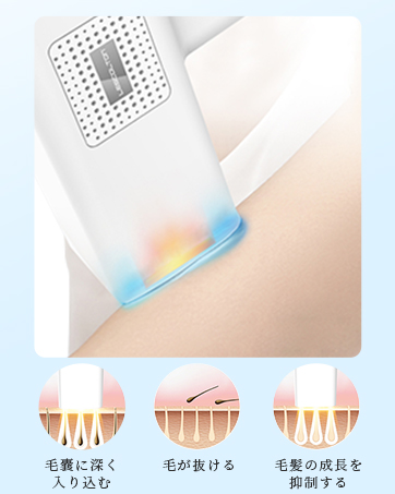 Amazon | 光美顔器 脱毛器 レーザー 脱毛器 vio対応 無痛冷感
