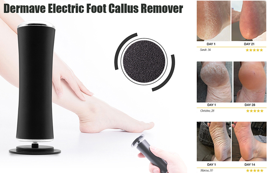 dermave foot callus remover
