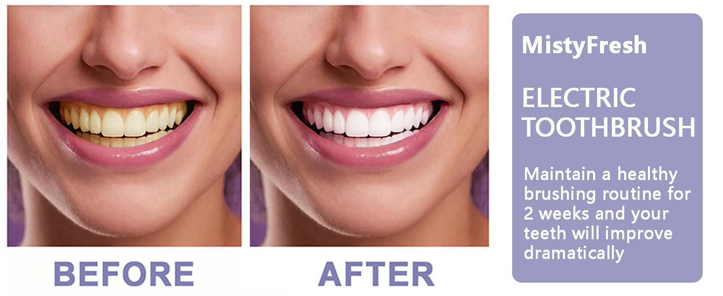 Ultrasonic Electronic Toothbrush