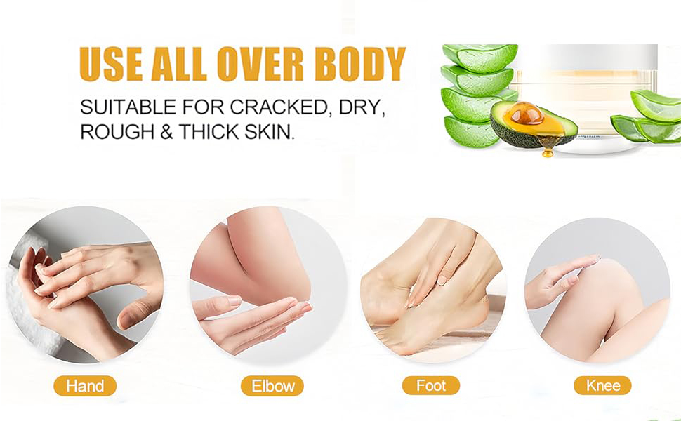 salicylic acid cream