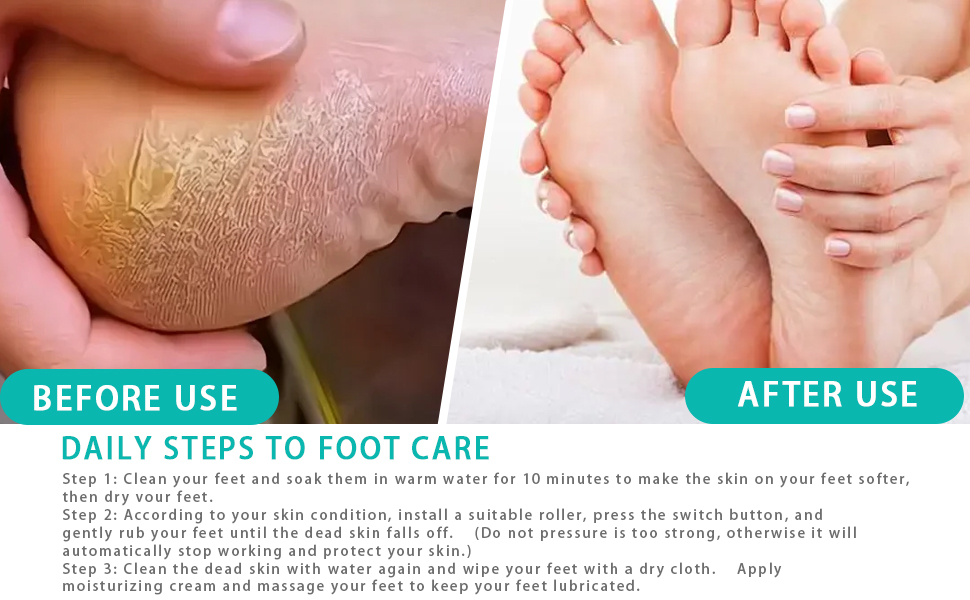 Foot grinding device