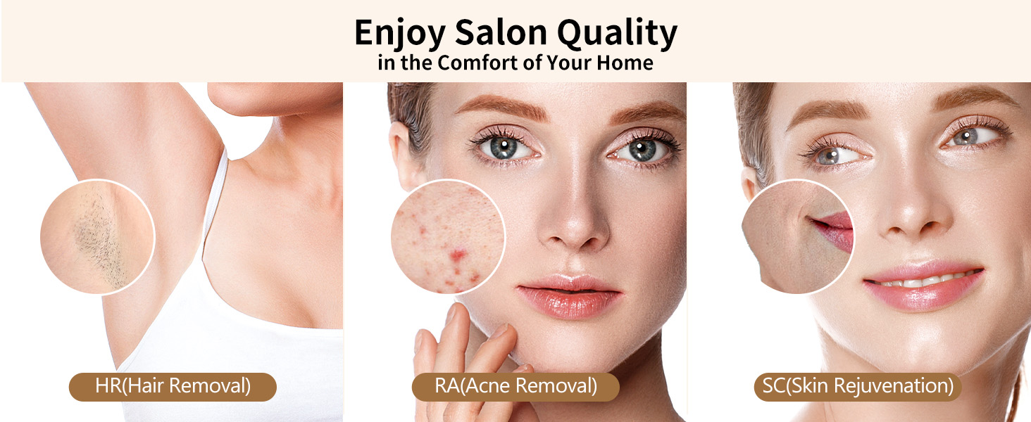 3-in-1 IPL Hair Removal Device