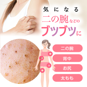 Pure Lupie 二の腕ざらざらケア Pure Lupie 二の腕ざらざらケア Amazon | Pure Lupie