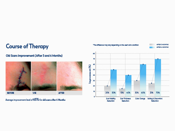 100% Silicone Scar Gel Scar Cream M3