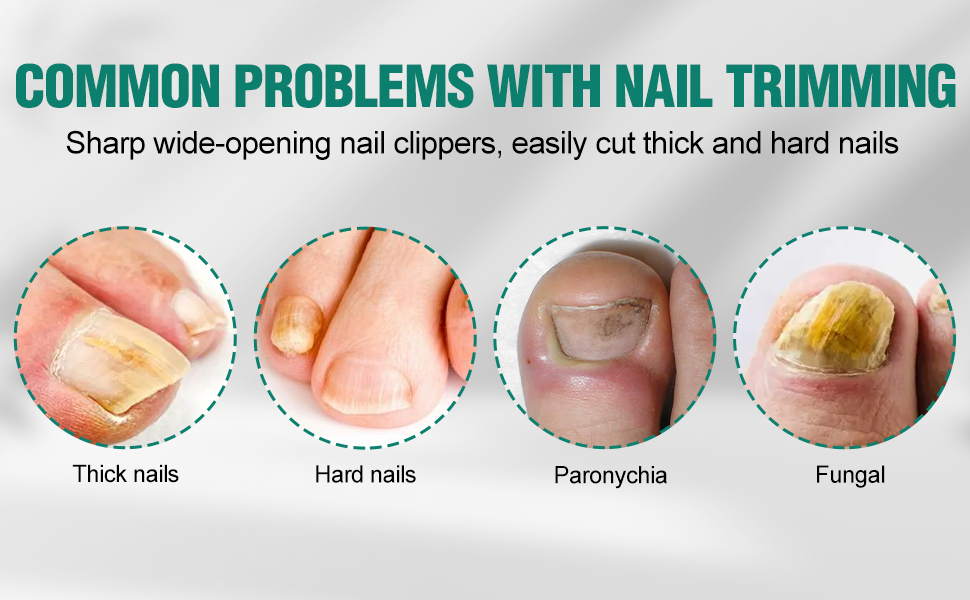 beak nail