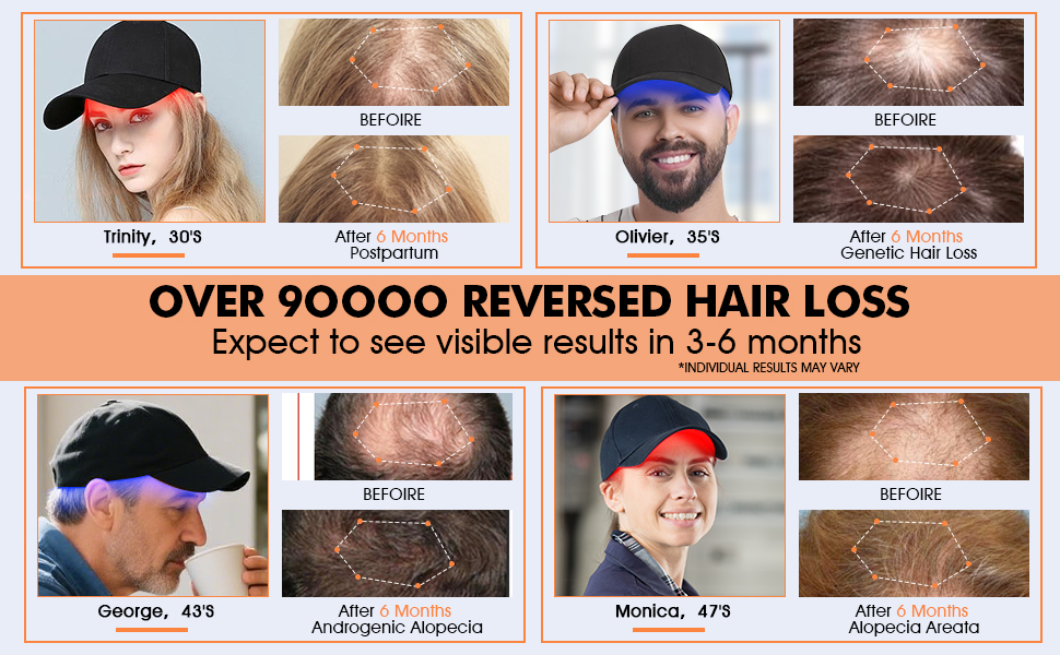 hair growth cap 02