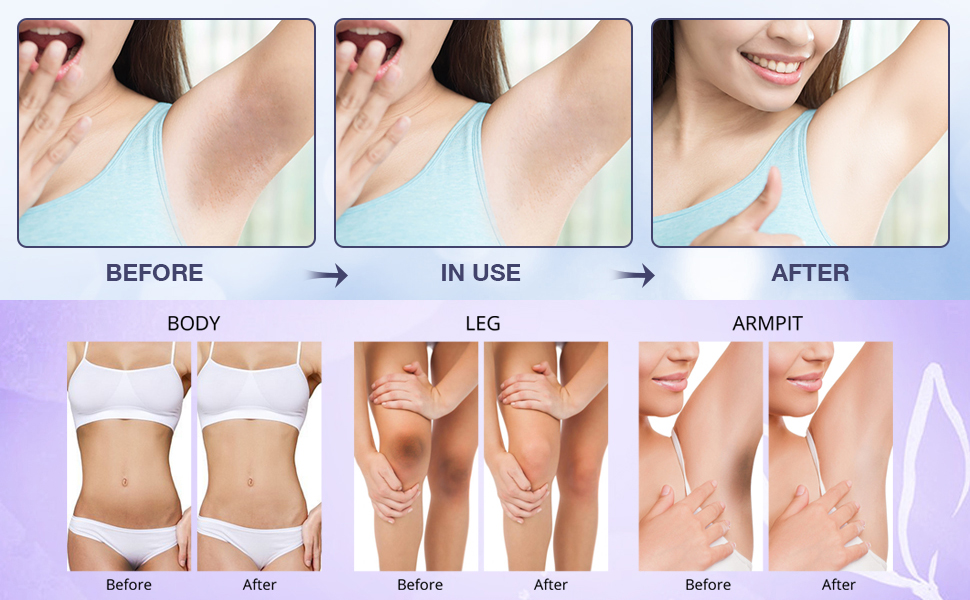 skin bleaching cream for intimate areas