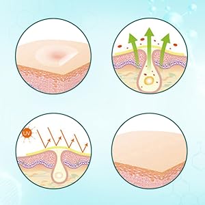 hydrocolloïde patch