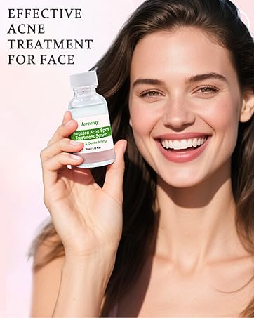 Acne Treatment for Face