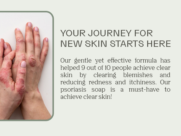 Lump of coal soap men eczema black Dead Sea carbolic acne mud adults bend basis