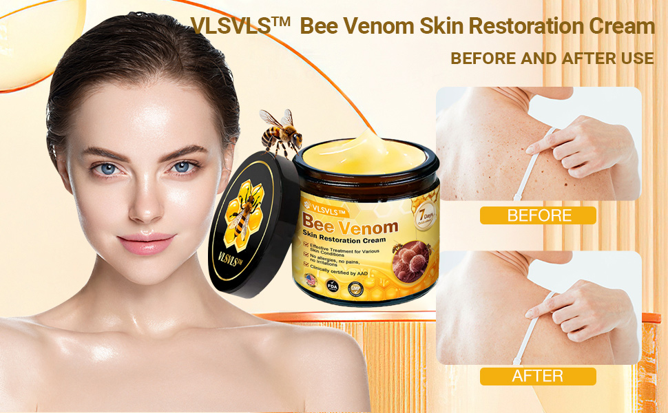 Amazon.com: VLSVLS Bee Venom Skin Restoration Cream, Professional Bee - Does Bee Venom Work To Remove Skin Tags