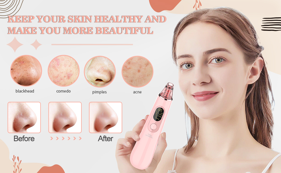 Blackhead Remover Pore Vacuum, Facial Pore Cleanser Pimple Acne Comedone Extractor with 4
