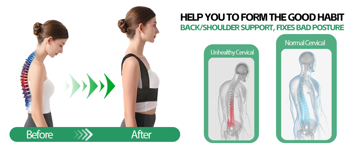 posture corrector