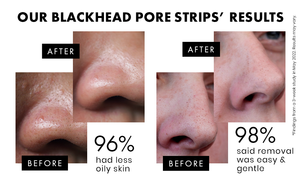 blackheads blackhead strips black head strips for nose pore strips blackhead nose strips