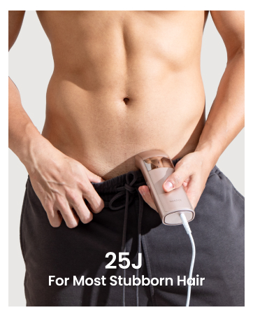 ipl hair removal