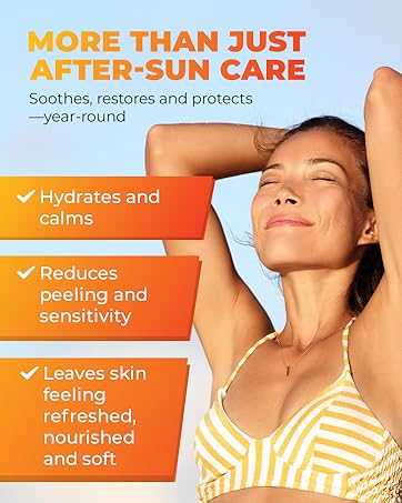 AfterBurn Recovery Lotion