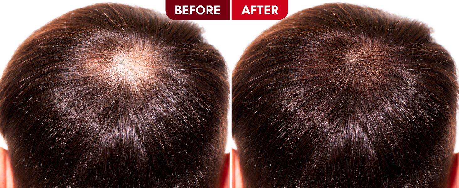 Strong Roots Men Beard + Hair Oil