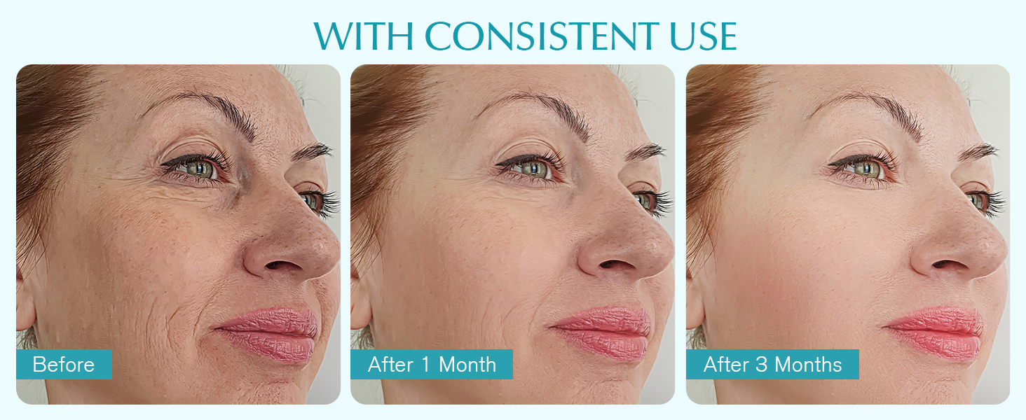 Retinol Cream for Wrinkles