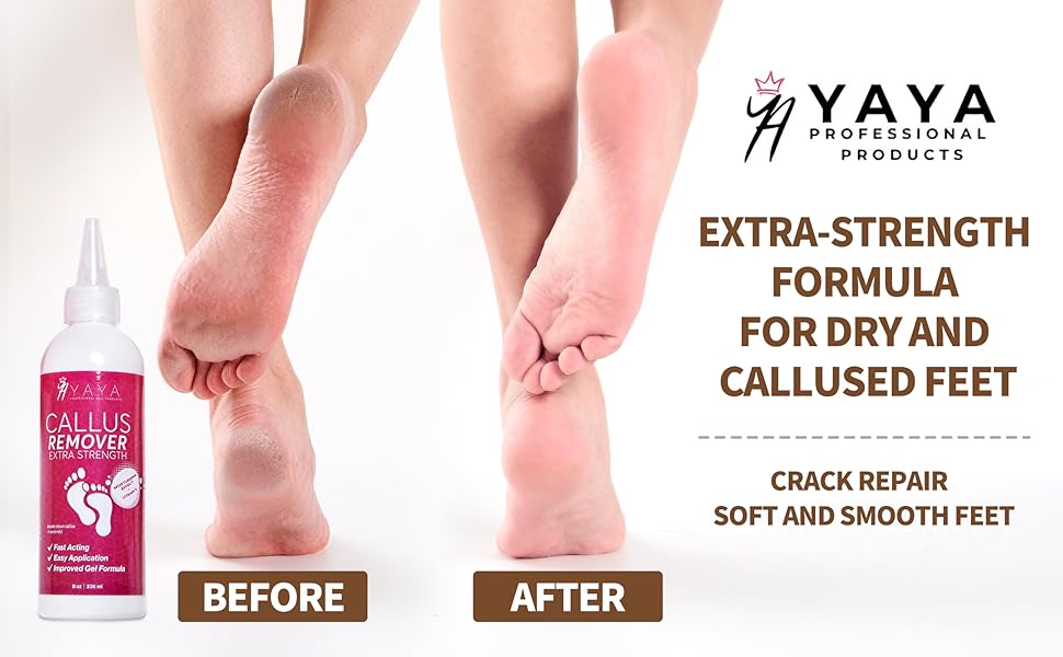 Callus scrub