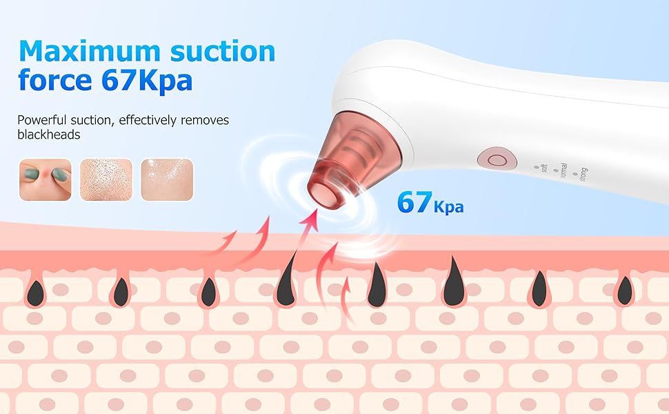 This is a blackhead remover for facial blackheads, oil and acne