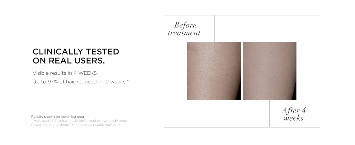 CLINICALLY TESTED ON REAL USERS. Visible results in 4 WEEKS. Up to 97% of hair reduced in 12 weeks*