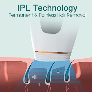 IPL Technology