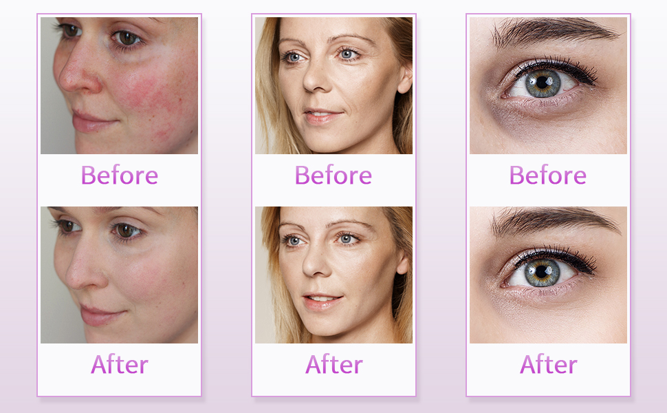 Deciniee LED Face Mask, 7 Color LED Face Light Therapy Mask, LED Light