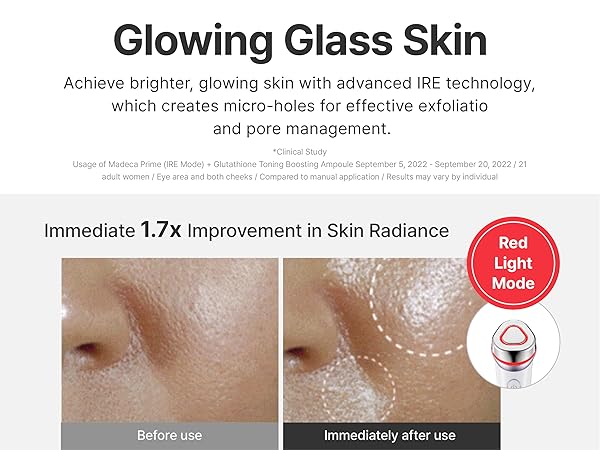 Amazon.com: Centellian 24 Madeca Prime Facial Toning Device