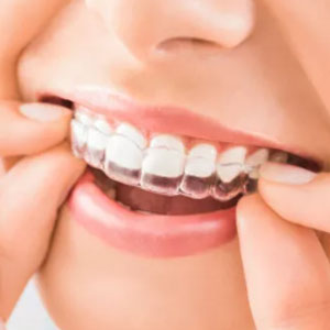 di Denti Finti Bretelle Bianche