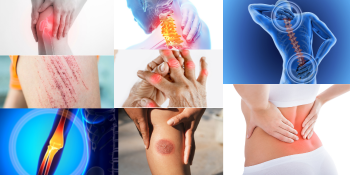 Comfrey for muscle aches, joints, fractures, itchiness, strains and burns