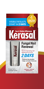 biting,adults,toenail,extra strength,efero repair gel,nixxit,dr g ,kit,tolnaftate,growth,damaged