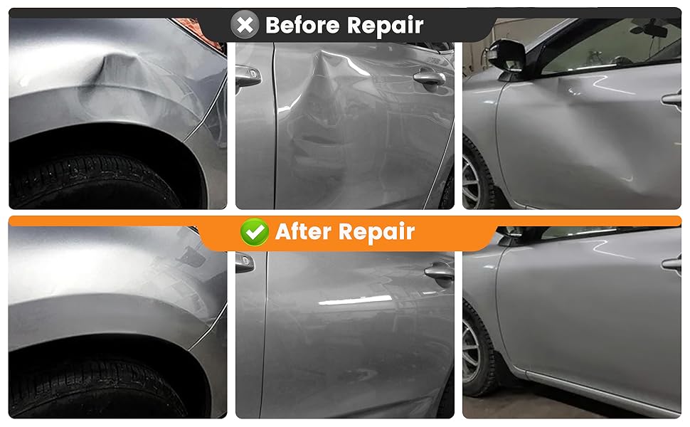 dent removal