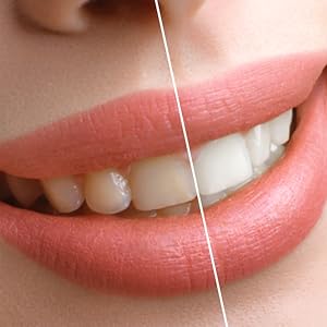 Prime Smile Brightest v34 Colour Corrector Purple Teeth Whitening