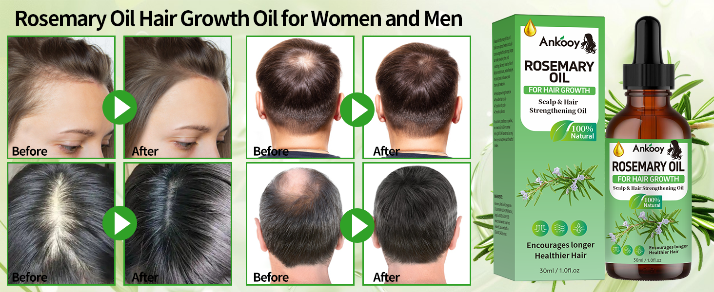 Rosemary Oil for Hair Growth