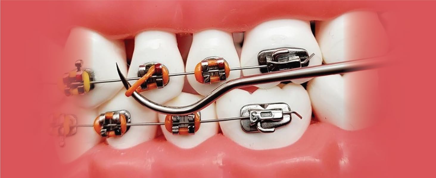 Artman Dental Ligature Ties Removal Tool Stainless Steel Braces Color Bands Remover