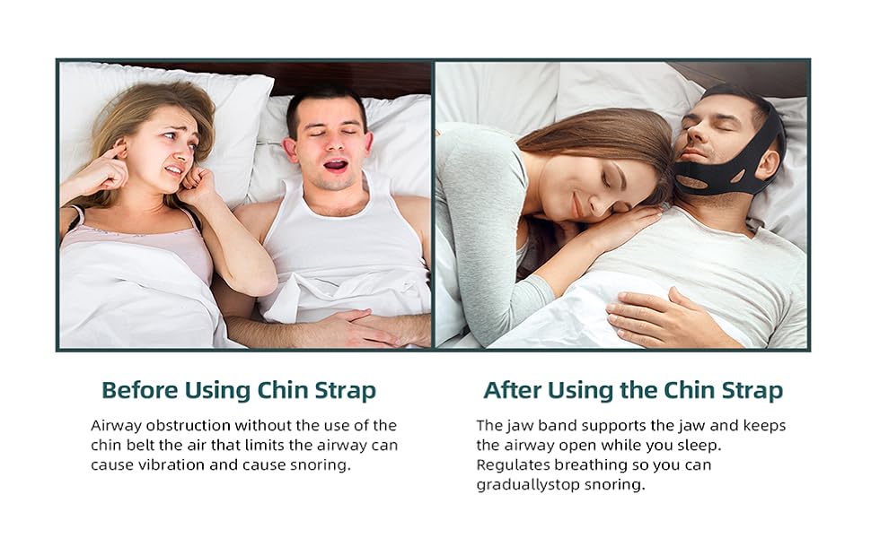 cpap chin strap to keep mouth closed