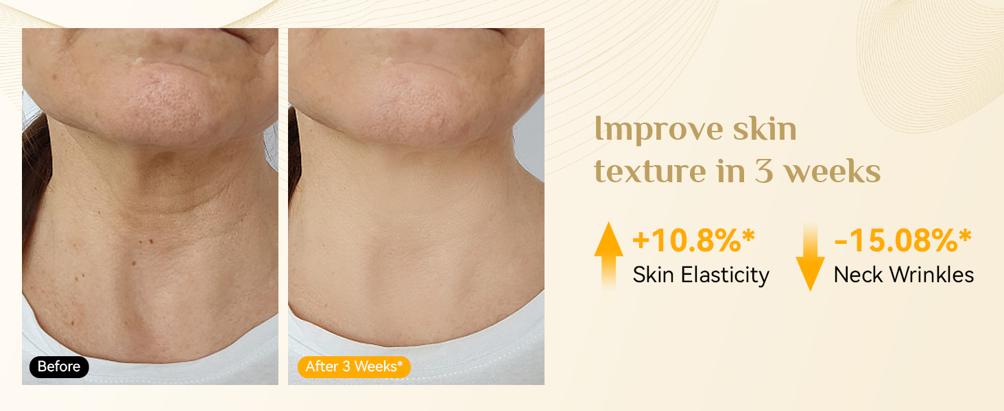 Before and after comparison of neck skin, showing improved texture. Text indicates 10.8% increase in skin elasticity and 15.08% reduction in neck wrinkles over 3 weeks.