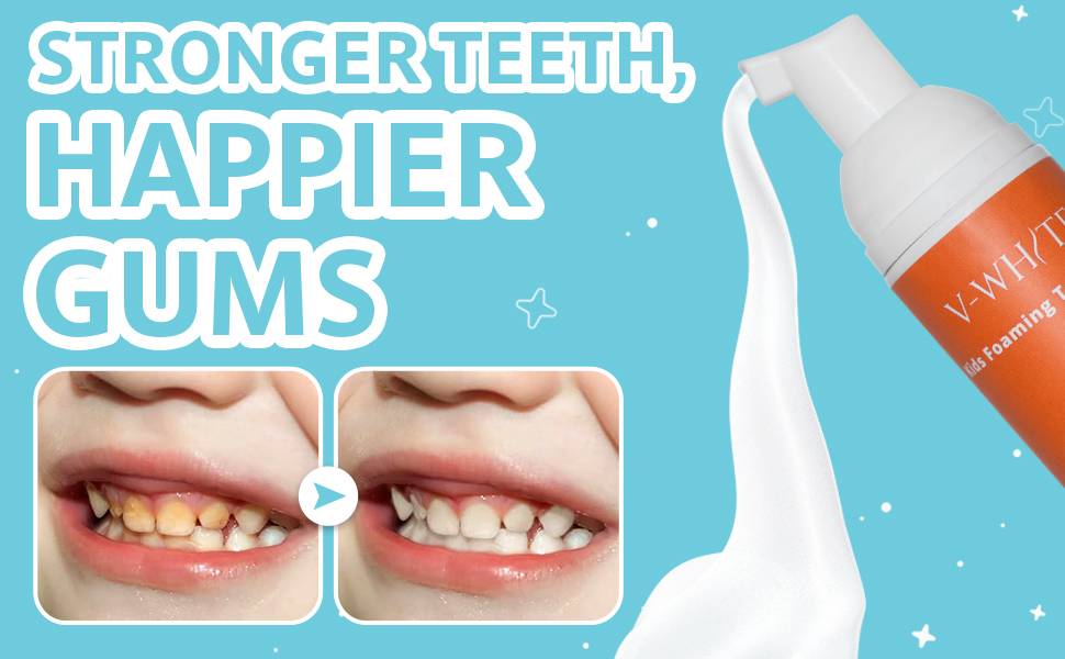 Amazon.com: V-White Foam Teeth Whitening Toothpaste