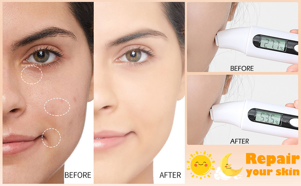 Retinol Moisturizer -2.5% Retinol Anti-Aging Face Cream Skin Care With Hyaluronic