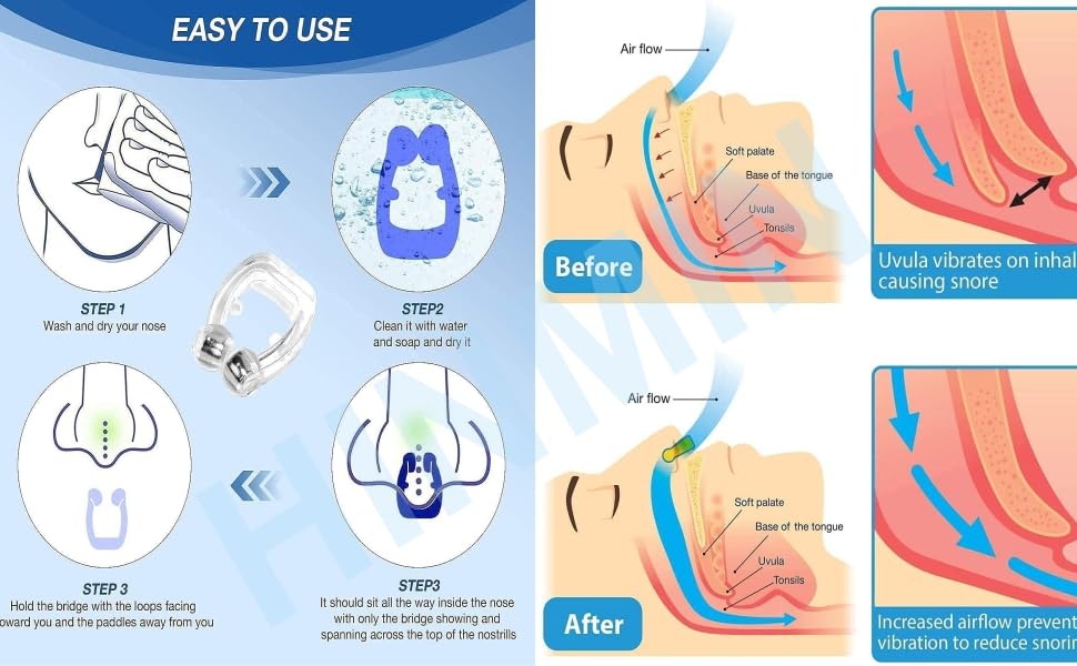 noring Relief Nasal Strips Your Nose Instantly Nose Strips for Snoring Anti Snoring Device