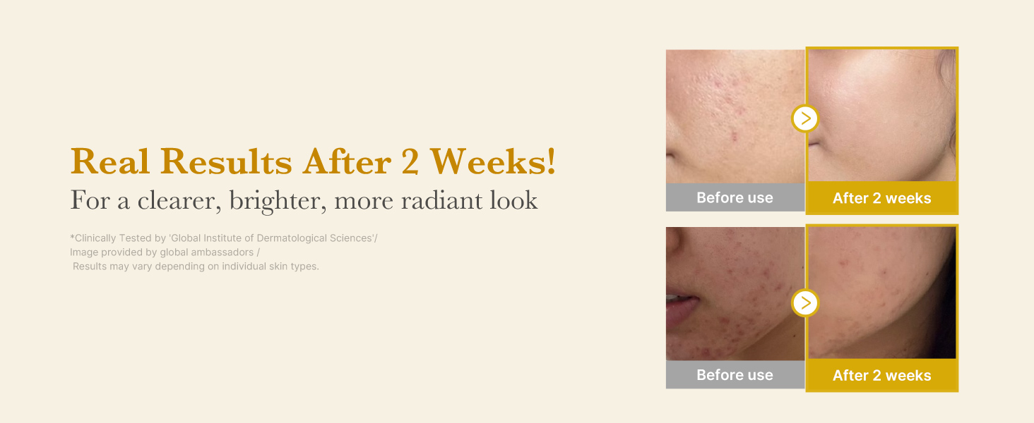 Before and after results