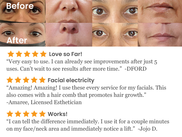 scscNuDerma Portable Handheld High Frequency Skin Therapy Wand Machine w/Neon – Anti-Aging 