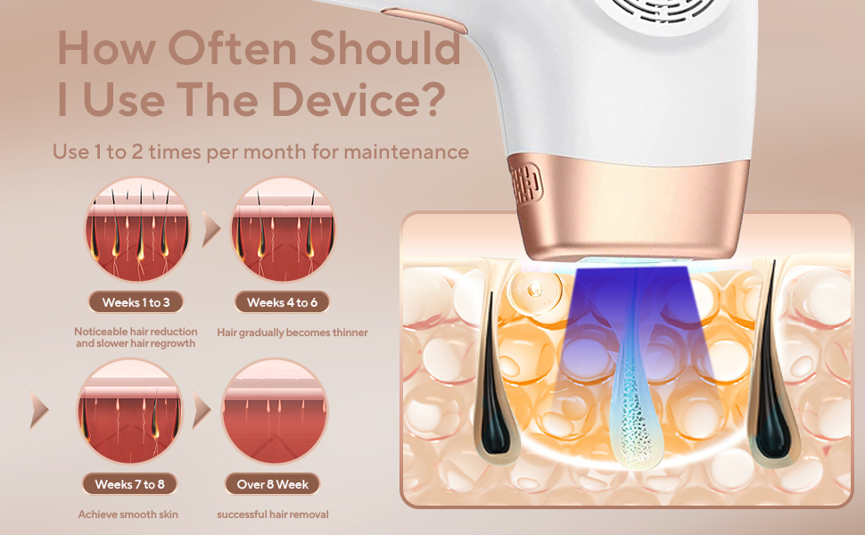 laser hair removal IPL laser hair removal