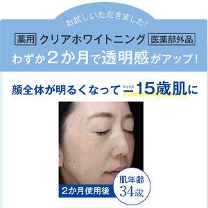 ヴァーナル クリアホワイトニングA 薬用美白化粧水 100ml 美容 小物 格安 Amazon | ヴァーナル 薬用 クリアホワイトニング 100mL 美白