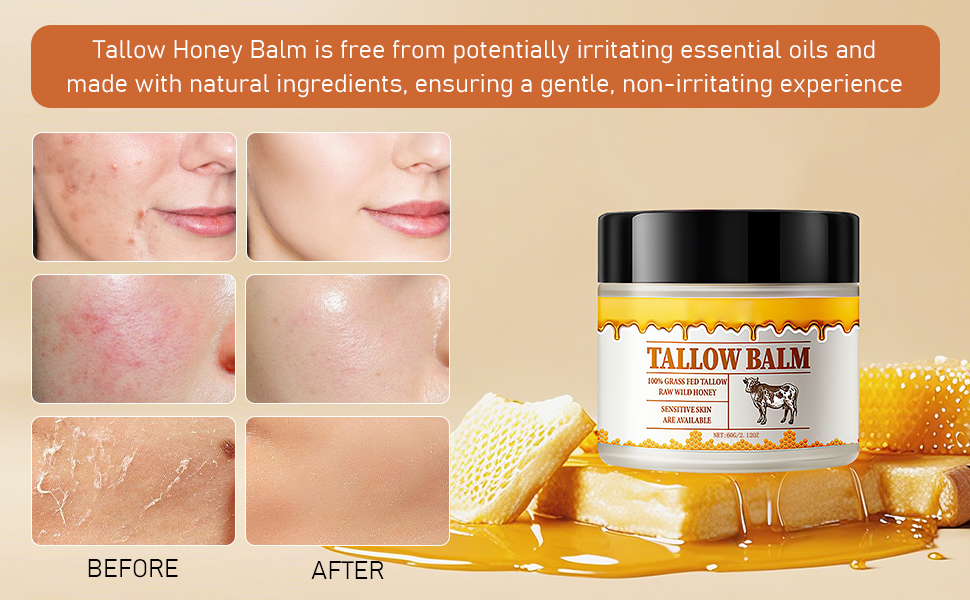 Tallow and Honey Balm, Premium Beef Tallow and Wild Honey