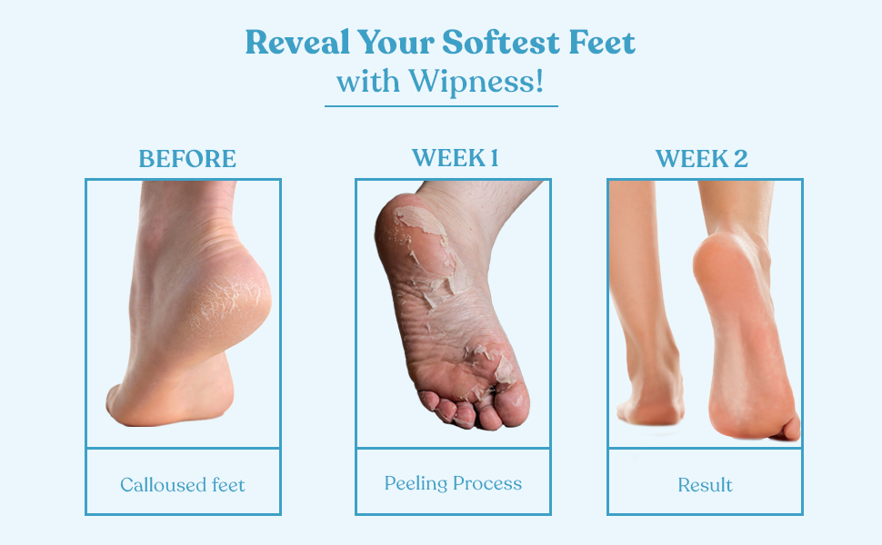 wipness foot pelling benifits