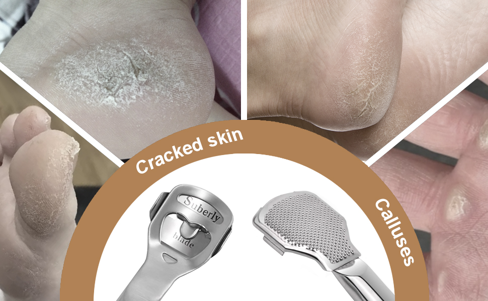 36 Pcs Callus Shaver for Feet Set